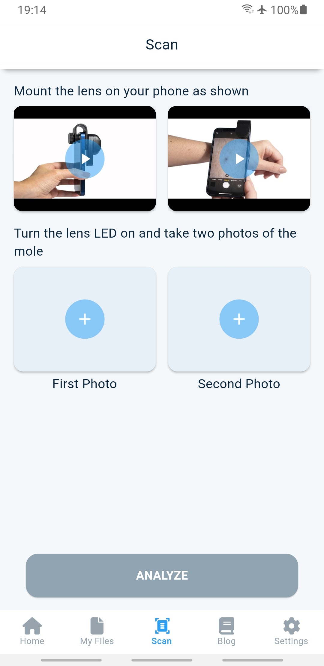 VITEYE BUNDLE: Dermascope smartphone attachment + App